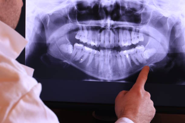 Best Emergency Root Canal Therapy in Windsor, CA